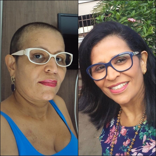 MULHERES DE PODER: a história de Jussane. Ela venceu o câncer duas vezes, com sorriso no rosto, fé e esperança no coração