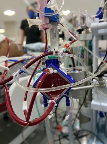 Morre o paciente com coronavírus que fazia uso da ECMO em Sergipe