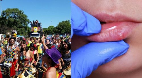 Carnaval: cinco doenças mais comuns que podem ser passadas pelo beijo