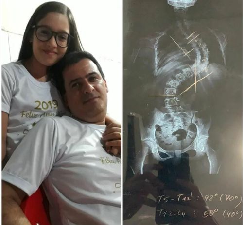 Família realiza Vakinha Virtual em prol de cirurgia de uma adolescente de Itabaiana